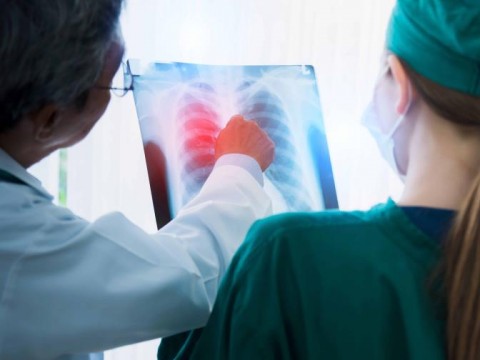 Inmunoterapia, otra alternativa en la lucha contra el c&aacute;ncer de pulm&oacute;n