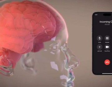 Elon Musk anuncia el implante del primer chip cerebral de Neuralink en un ser humano