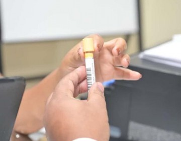 Senasa informa que atendi&oacute; a 9,477 afiliados por c&aacute;ncer de pr&oacute;stata entre enero y octubre