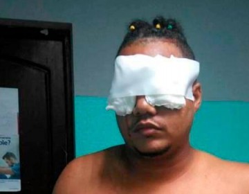 M&eacute;dicos podr&aacute;n salvar un ojo del joven que fue atacado con tijeras